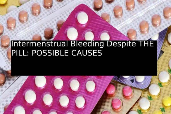 Intermenstrual Bleeding Despite THE PILL_ POSSIBLE CAUSES
