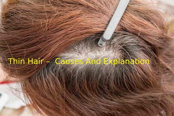 Thin Hair –  Causes And Explanation