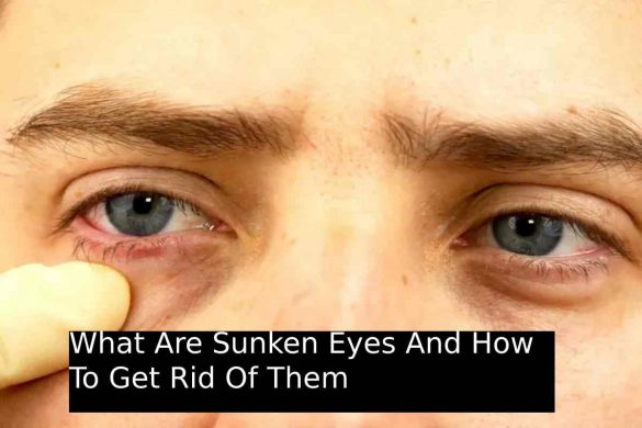 What Are Sunken Eyes And How To Get Rid Of Them